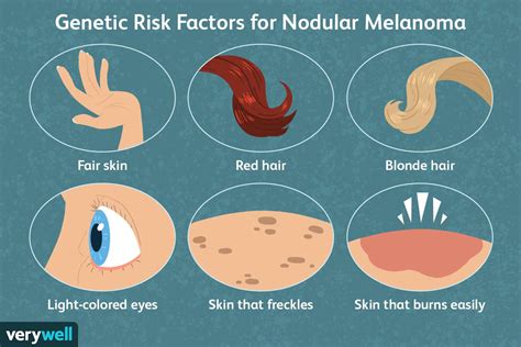 what is the real cause of melanoma